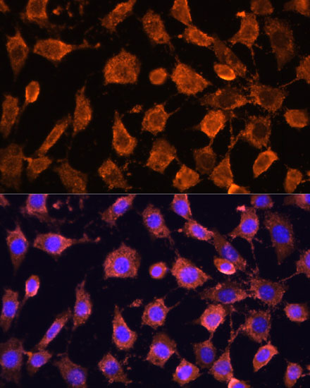 RPL11 Rabbit polyclonal antibody