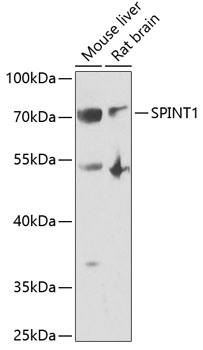 SPINT1 Rabbit polyclonal antibody