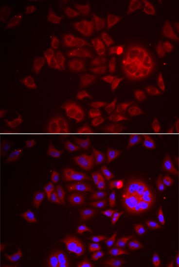 SPINT1 Rabbit polyclonal antibody