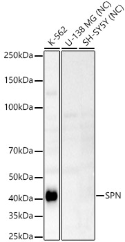 SPN Rabbit polyclonal antibody