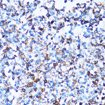 SPN Rabbit polyclonal antibody