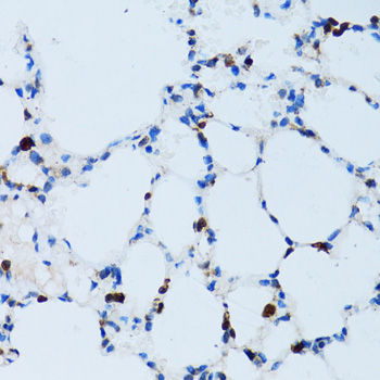 SPN Rabbit polyclonal antibody