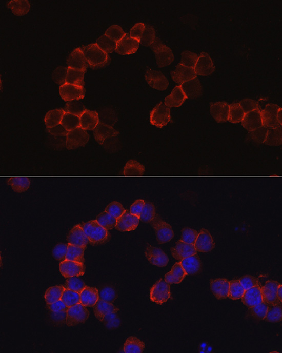 SPN Rabbit polyclonal antibody
