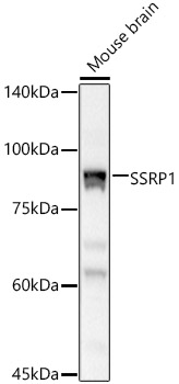 SSRP1 Rabbit polyclonal antibody
