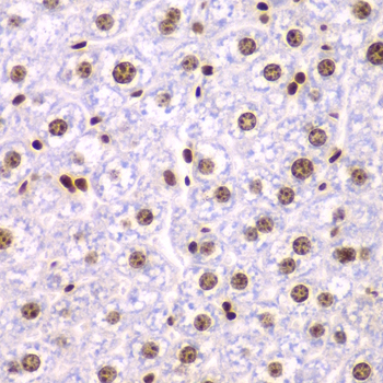 SSRP1 Rabbit polyclonal antibody