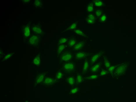 SSRP1 Rabbit polyclonal antibody