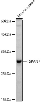 TSPAN7 Rabbit polyclonal antibody