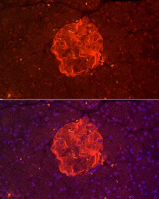 TSPAN7 Rabbit polyclonal antibody