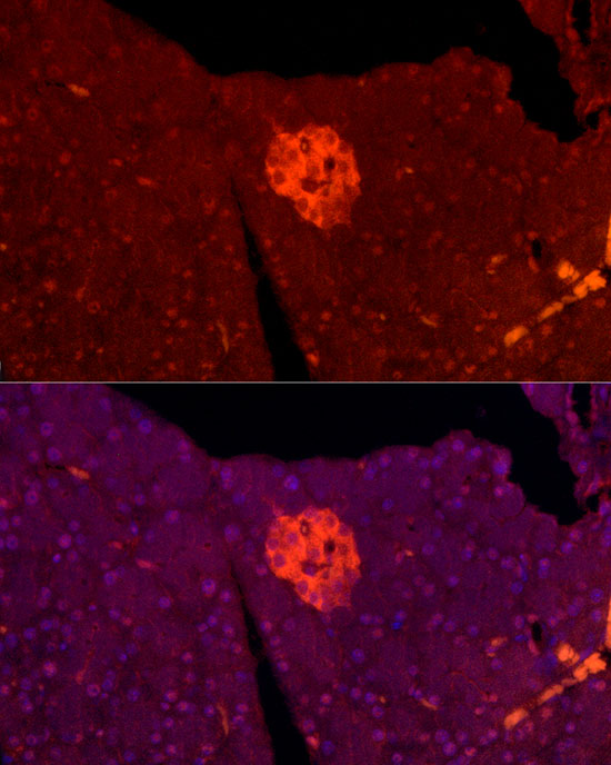TSPAN7 Rabbit polyclonal antibody