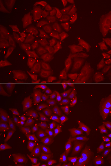 TPP2 Rabbit polyclonal antibody
