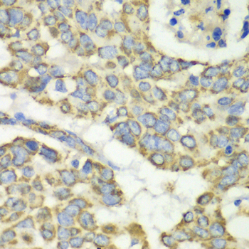 TUFM Rabbit polyclonal antibody