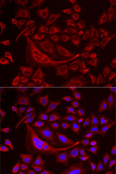 TUFM Rabbit polyclonal antibody