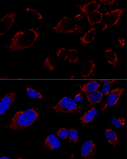 TUFM Rabbit polyclonal antibody