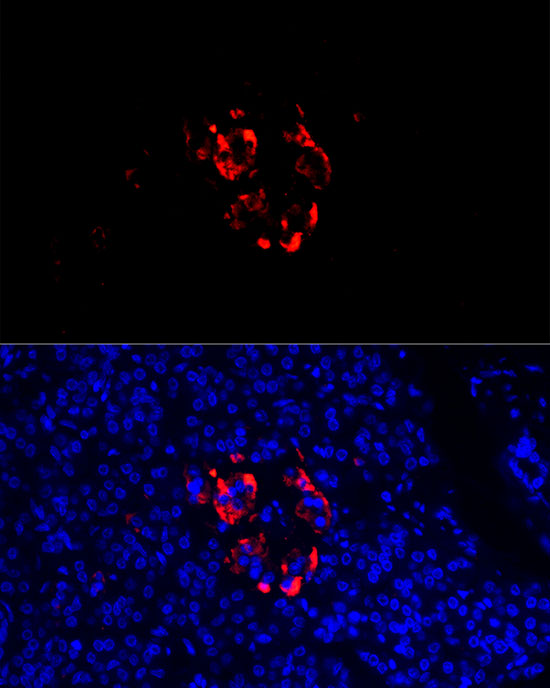 SCG2 Rabbit polyclonal antibody