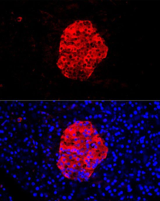 SCG2 Rabbit polyclonal antibody
