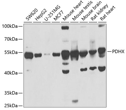 PDHX Rabbit polyclonal antibody