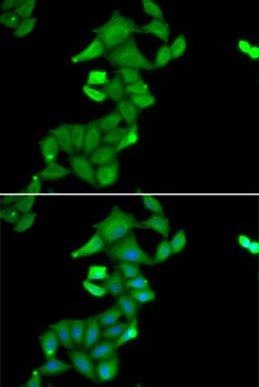 BLZF1 Rabbit polyclonal antibody