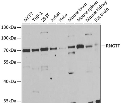 RNGTT Rabbit polyclonal antibody
