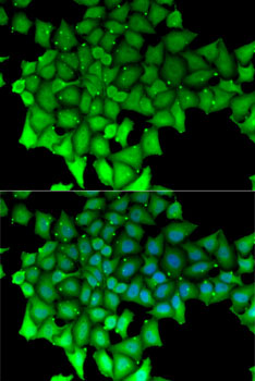 RNGTT Rabbit polyclonal antibody