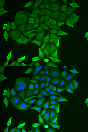 CD84 Rabbit polyclonal antibody