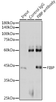 FIBP Rabbit polyclonal antibody