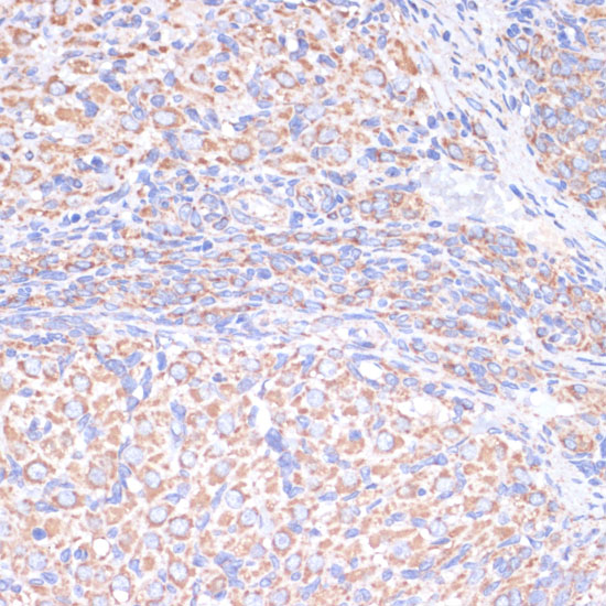 COX5A Rabbit polyclonal antibody