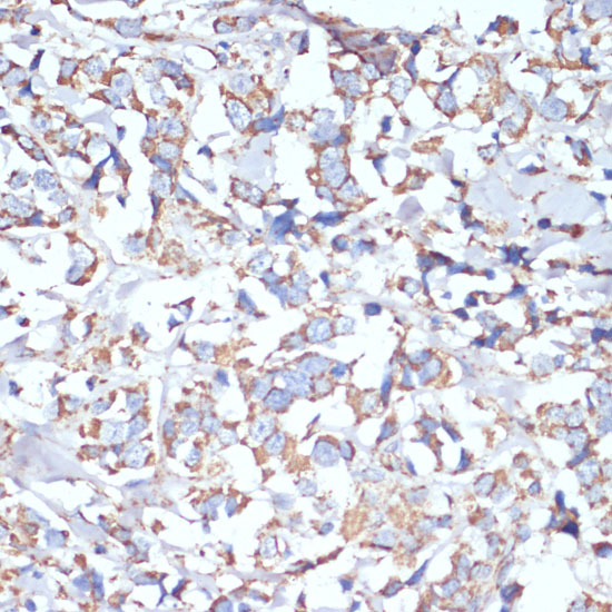 COX5A Rabbit polyclonal antibody