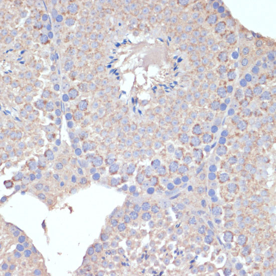 COX5A Rabbit polyclonal antibody
