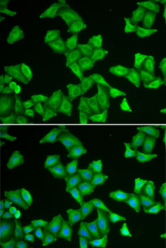 COX5A Rabbit polyclonal antibody