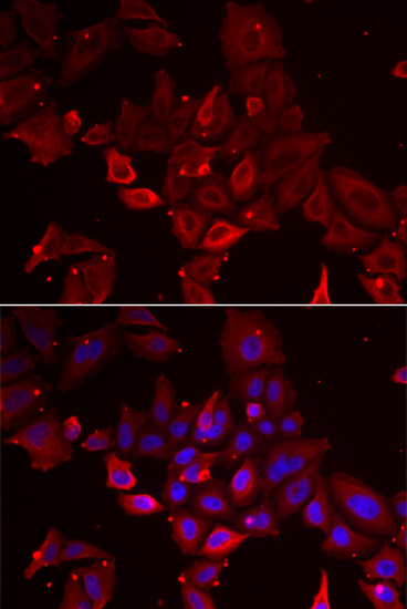 MYOT Rabbit polyclonal antibody