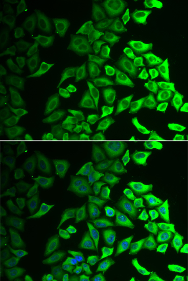 IL18BP Rabbit polyclonal antibody