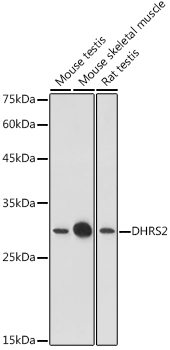 DHRS2 Rabbit polyclonal antibody
