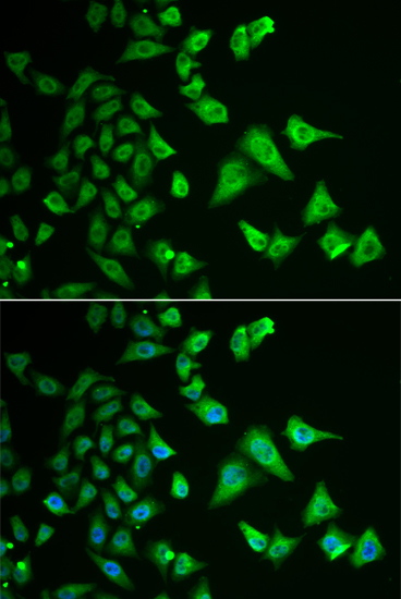 DHRS2 Rabbit polyclonal antibody