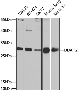 DDAH2 Rabbit polyclonal antibody