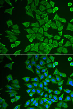 DDAH2 Rabbit polyclonal antibody