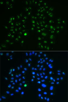 GNL3 Rabbit polyclonal antibody