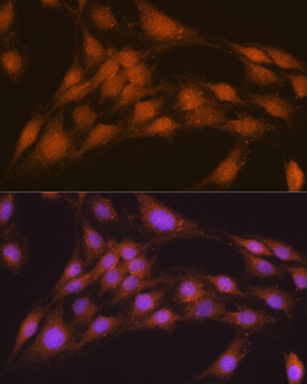 [KO Validated] NRBF2 Rabbit polyclonal antibody
