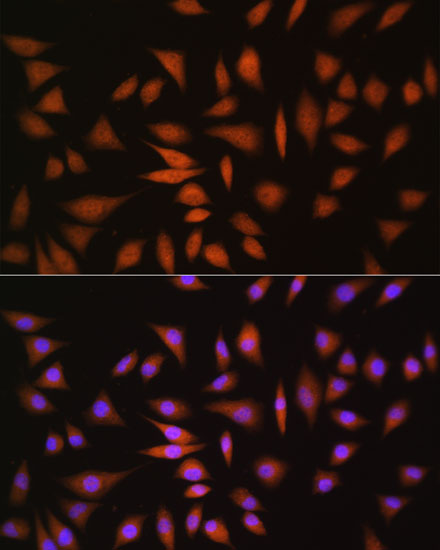 [KO Validated] NRBF2 Rabbit polyclonal antibody