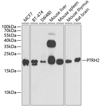 PTRH2 Rabbit polyclonal antibody