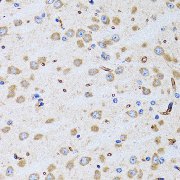 PTRH2 Rabbit polyclonal antibody