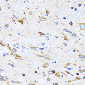PTRH2 Rabbit polyclonal antibody