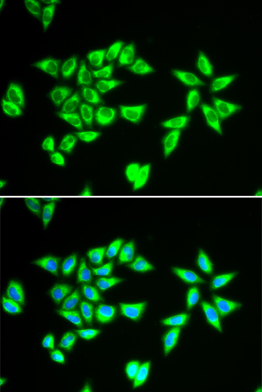 PTRH2 Rabbit polyclonal antibody