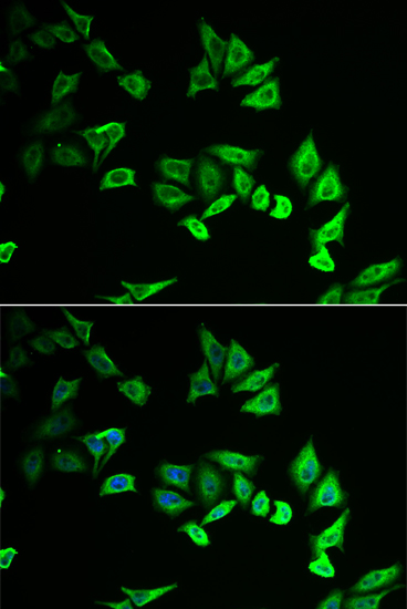 MYOZ2 Rabbit polyclonal antibody
