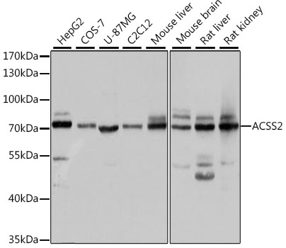 ACSS2 Rabbit polyclonal antibody