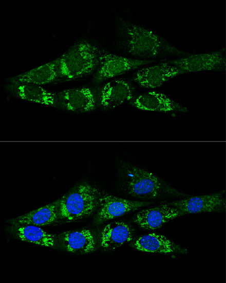ACSS2 Rabbit polyclonal antibody
