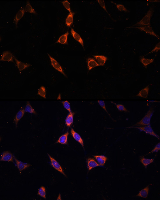 ACSS2 Rabbit polyclonal antibody