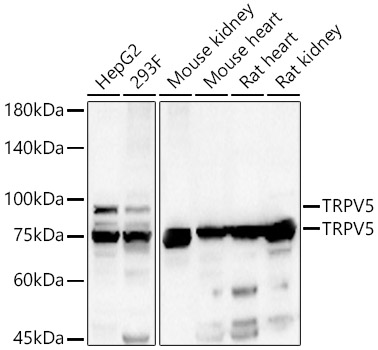 TRPV5 Rabbit polyclonal antibody