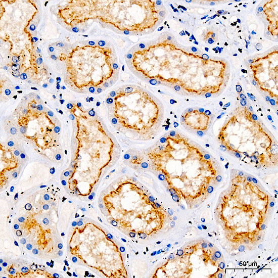 TRPV5 Rabbit polyclonal antibody