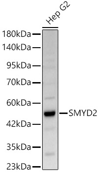 SMYD2 Rabbit polyclonal antibody