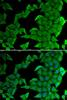 SMYD2 Rabbit polyclonal antibody